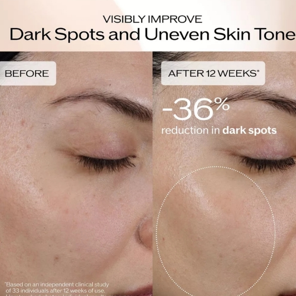 NIB SHISEIDO BENEFIANCE DARK SPOT AND WRINKLE SMOOTHING SERUM - Picture 8 of 14